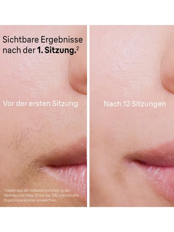 Braun Technik|Pflege & Gesundheit<IPL-Haarentfernungsgerät "Silk-expert Pro IPL PL7147" in Weiß/ Rosa
